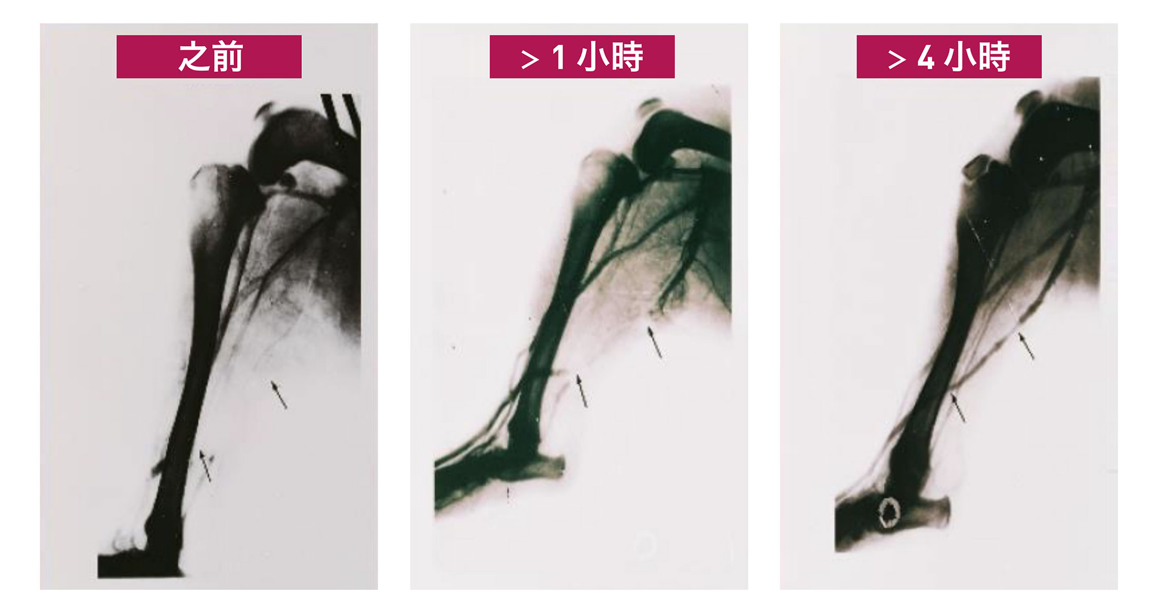 Before After